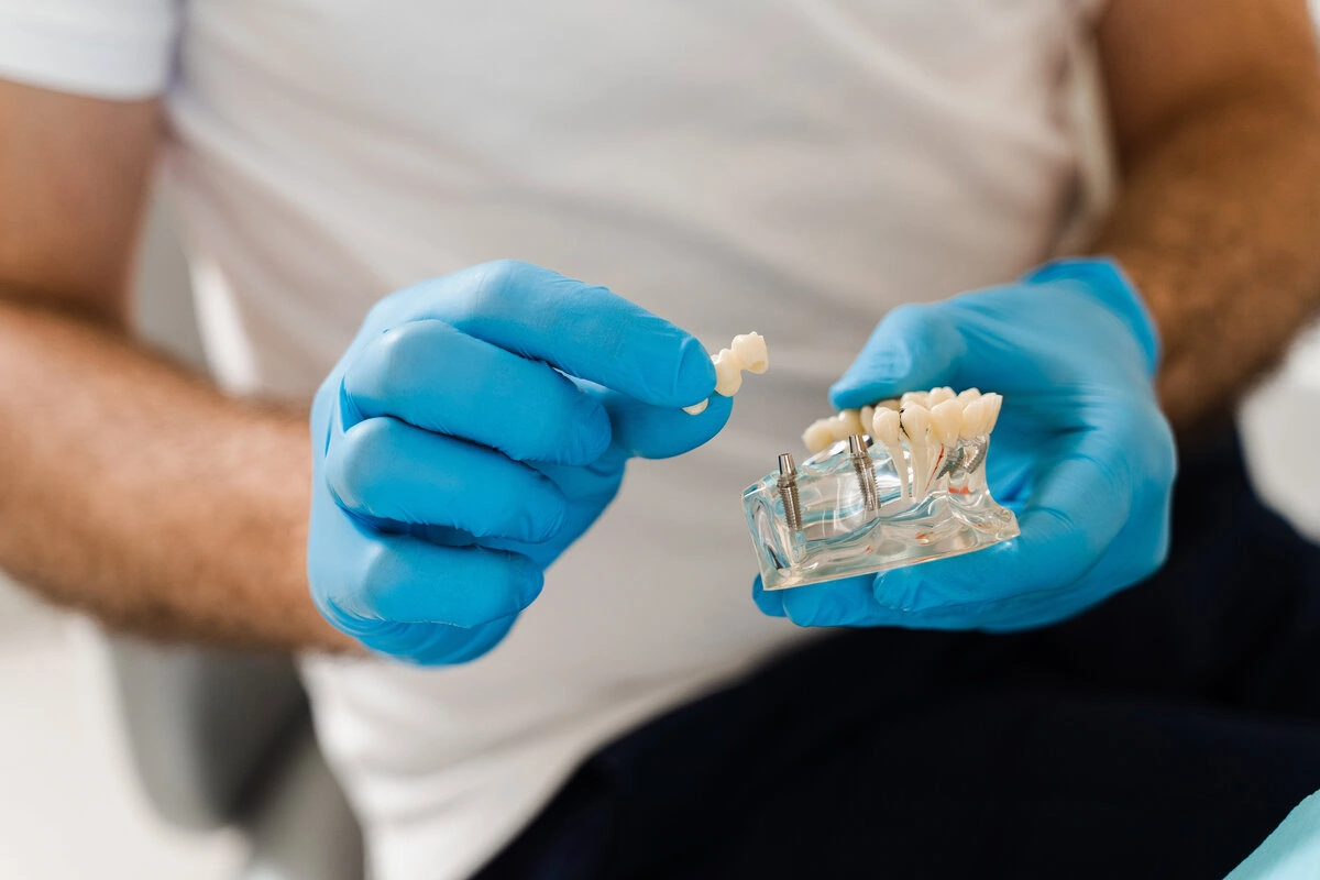 Dentist in blue gloves holding a dental implant model
