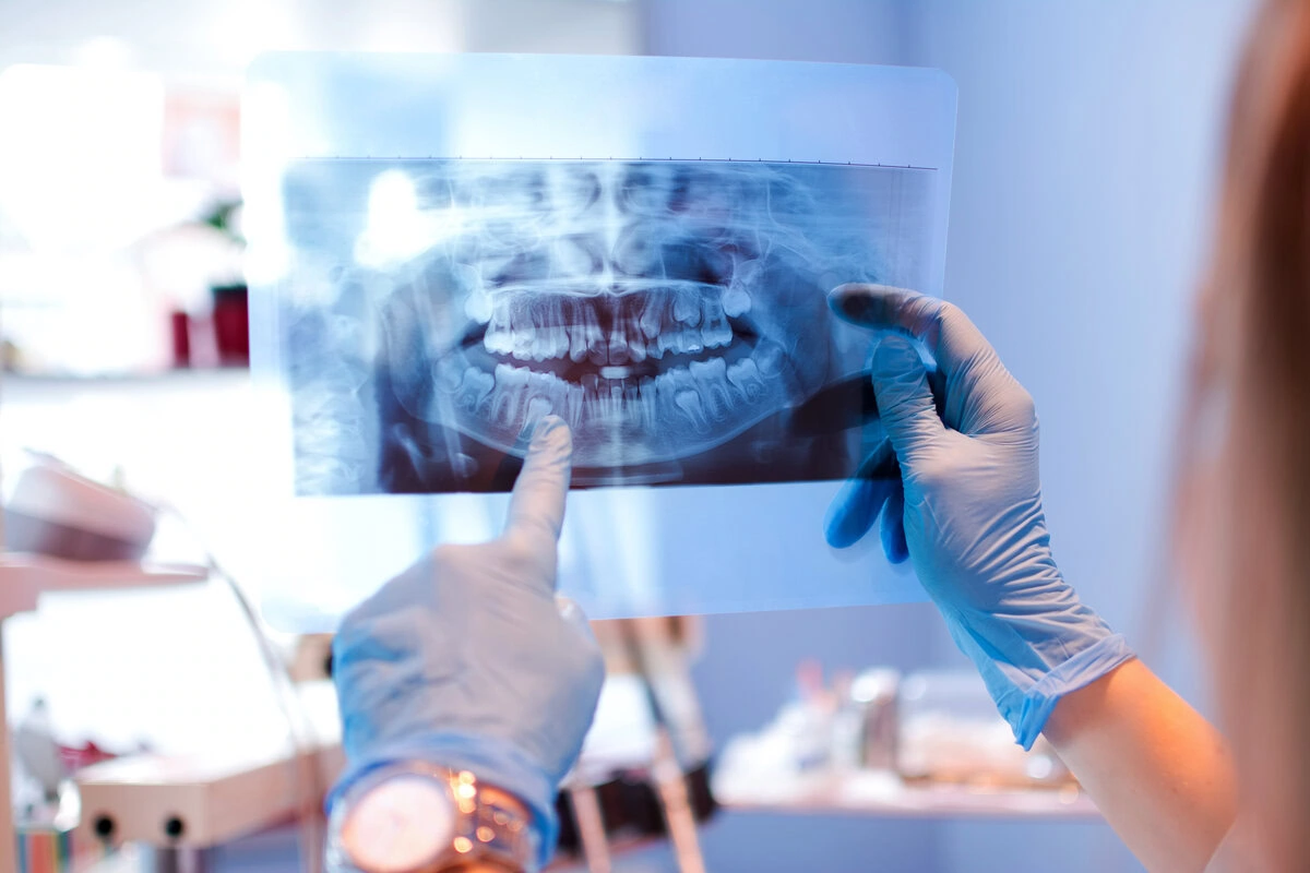 Dentist in gloves reviewing a panoramic dental X-ray